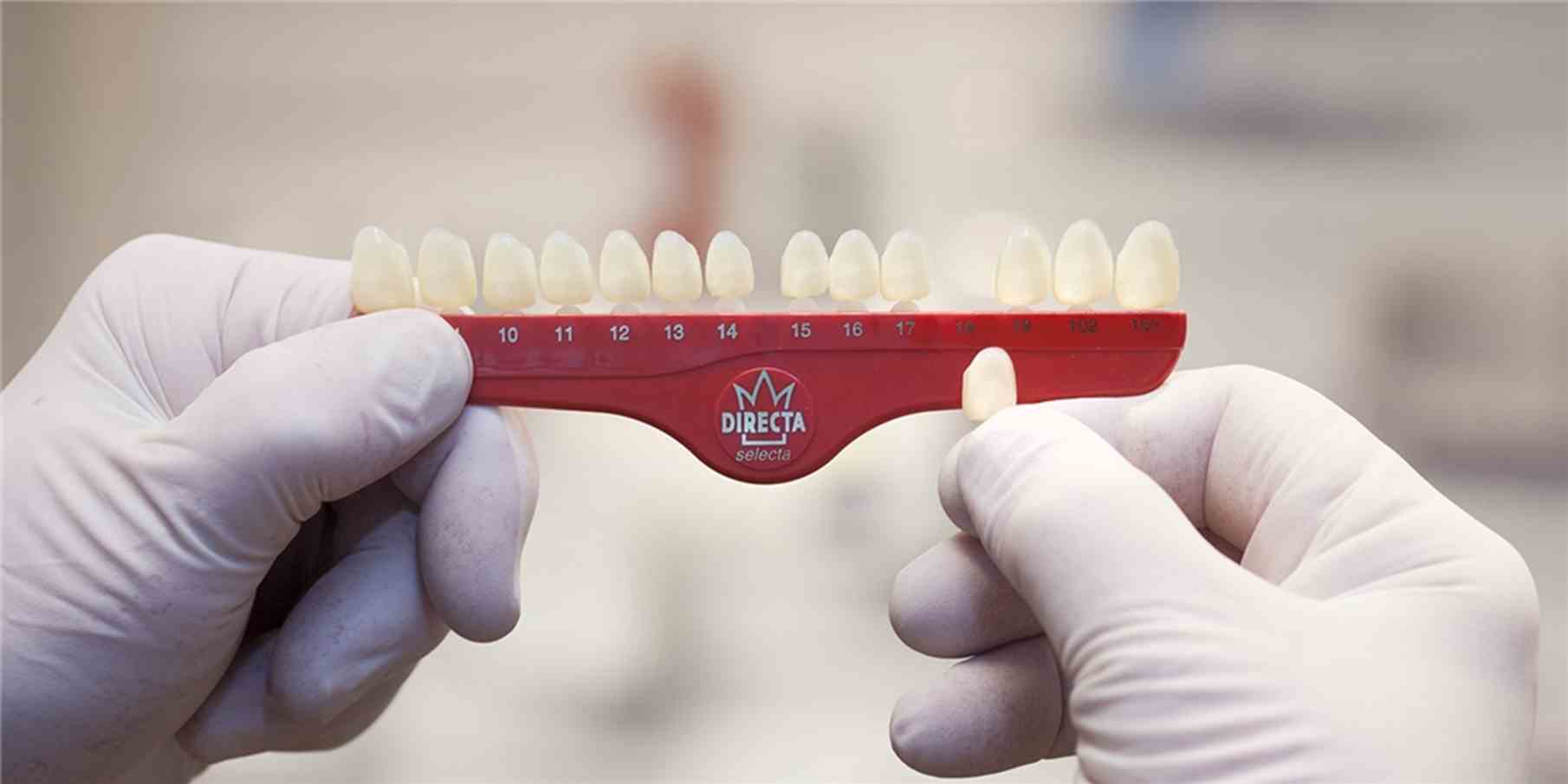 Directa-Kronen transl. Nr.25 5St Ds Directa-Kronen transl. Nr.25 5St Ds