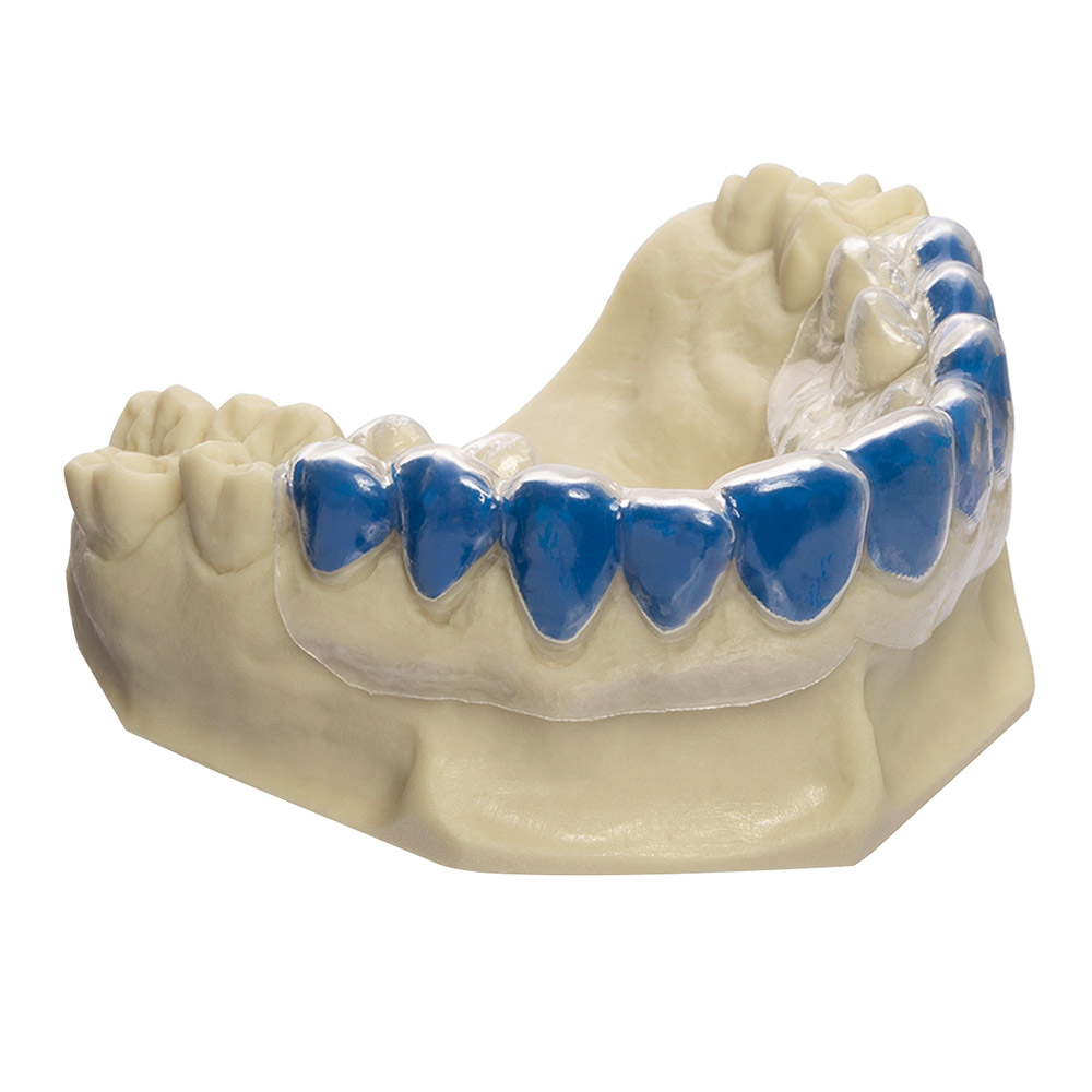 Bio Bleach soft 1,0x120mm 20St Bio Bleach soft 1,0x120mm 20St