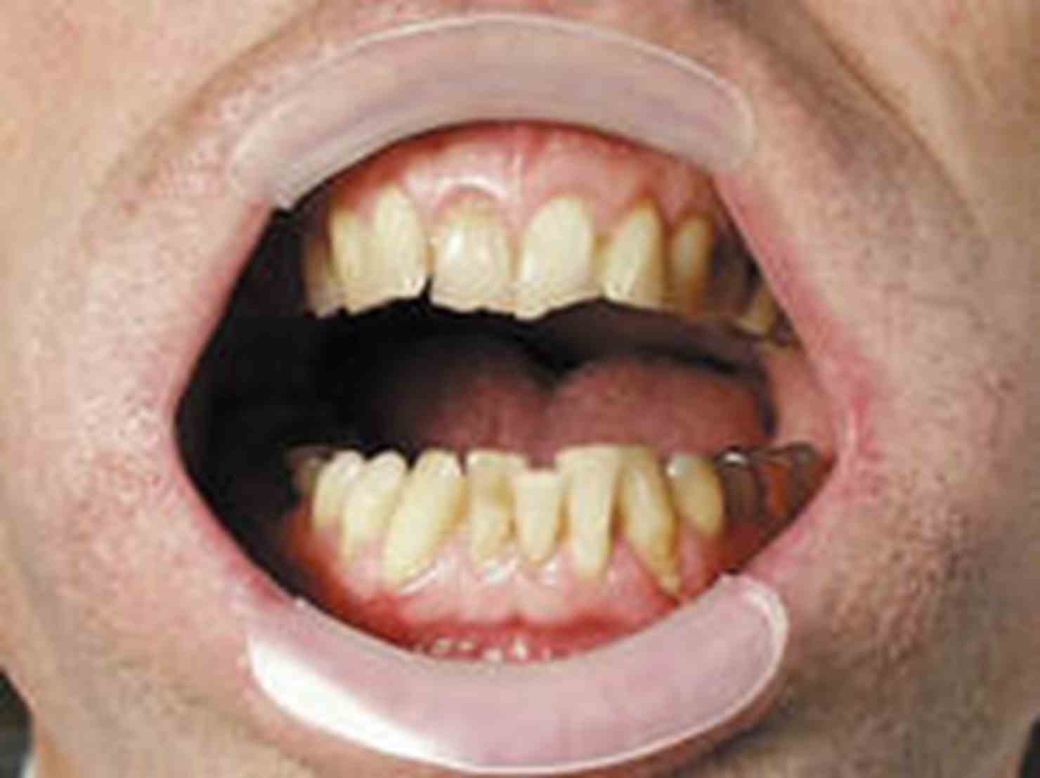 Spandex-Vertical 2xmedium/2xklein 4St Spandex-Vertical 2xmedium/2xklein 4St